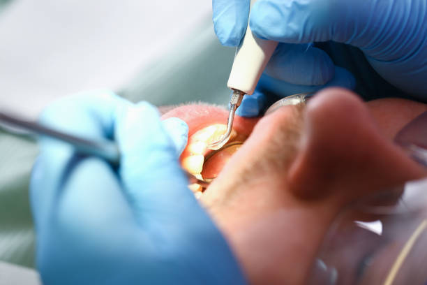 Best After-Hours Emergency Dentist in Rayville, LA